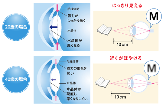 老視