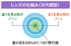 MFZ仕組み