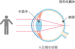 乱視の仕組み.gif