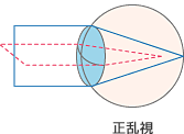 正乱視.gif