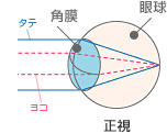 正視の角膜の形.gif
