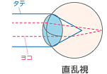 直乱視の角膜の形.gif