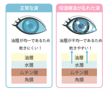 ドライアイ003157_03i.png
