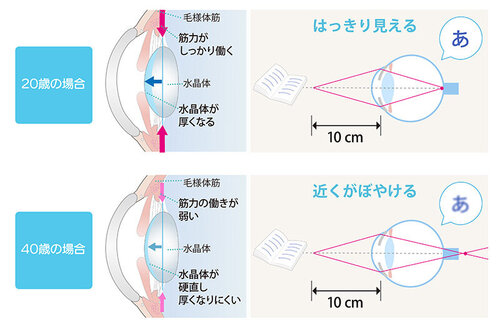 2_3.手元が見にくい.jpg