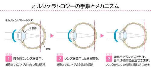 オルソimg_ortho_01.jpg