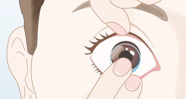 編集後手順説明_つけ方04.jpg