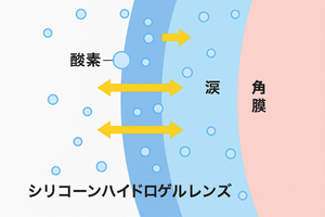 シリコン.png