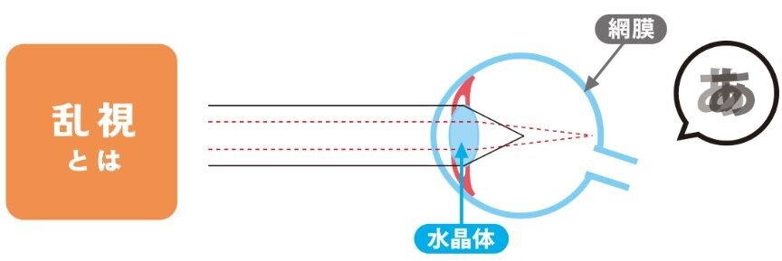 乱視.jpg