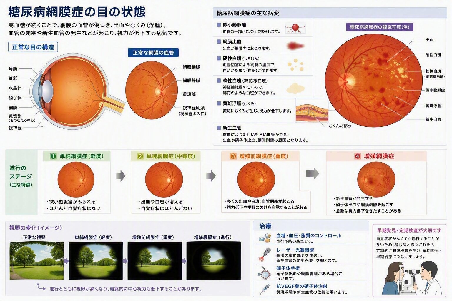 糖尿病網膜症.jpg