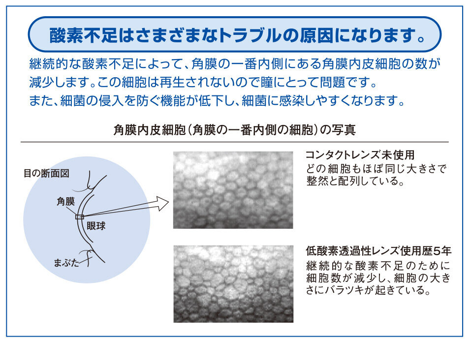 角膜内皮細胞の画像.jpg