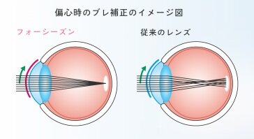 ⑤ブレ.jpg