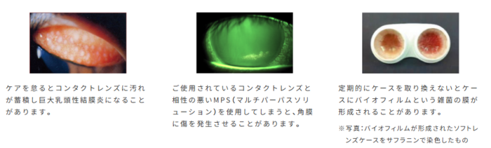 目のトラブル.png