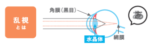 乱視.png