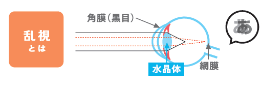 乱視.png