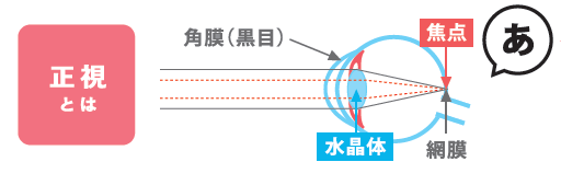 正視とは.png
