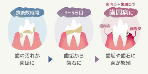 スクリーンショット 2026-03-05 153443.png