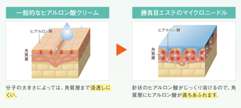 キャプチャ.PNG