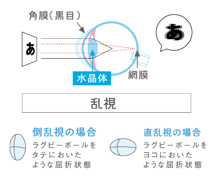 乱視.png