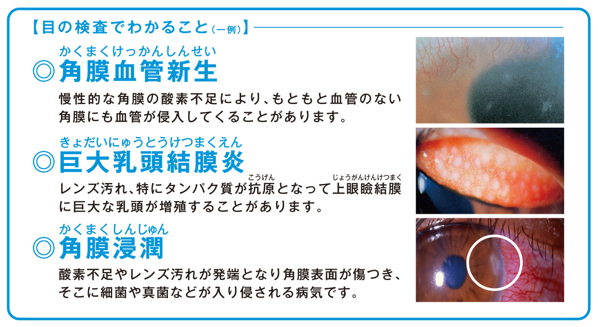 目の検査でわかる事.jpg