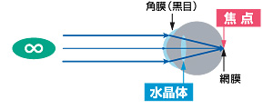 正視の見え方.jpg