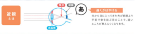 近視2.png
