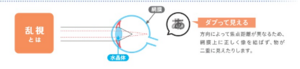 乱視2.png