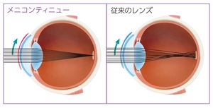 ブレ補正非球面図.jpg