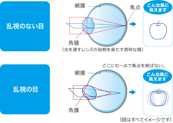 乱視用コンタクトレンズ | Jコンタクト