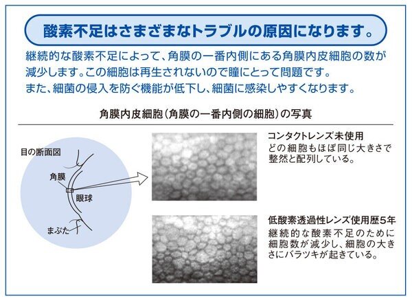 内川角膜.jpg