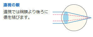 無題.pngのサムネイル画像