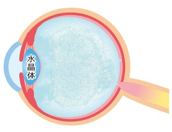 水晶体.jpg